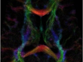 Nebula of the Brain