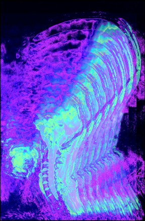 Blowback (7T MRI, Human Brainstem and Cervical Spinal Cord) A sagittal slice through the brainstem and cervical spinal cord, acquired using a gradient-echo pulse sequence and custom 22-channel brainstem and cervical spinal cord RF coil. The colour map was created in MATLAB and composed in GIMP.